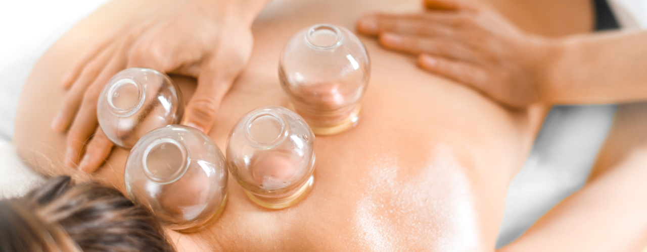 cupping-Prime-Physical-Therapy-Plains-PA