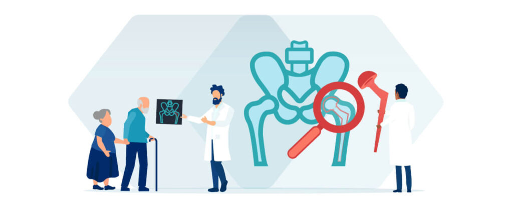 Hip Replacement Rehabilitation Tips